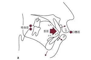 若林歯科での口腔育成(予防矯正)