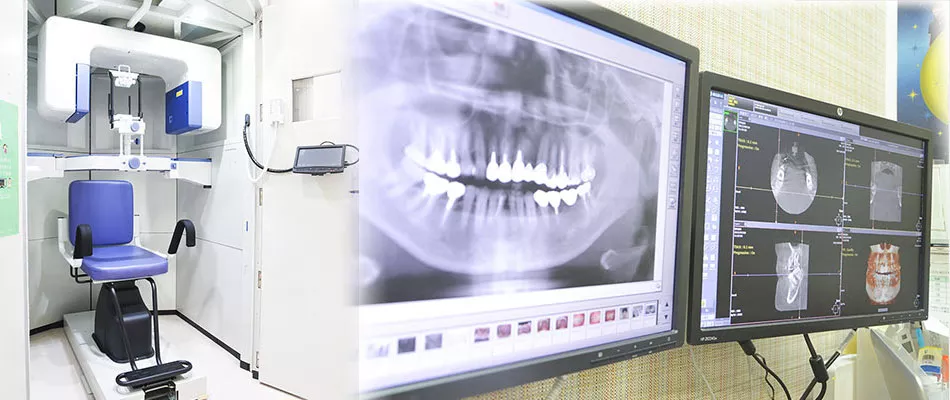 特徴2一般のレントゲンでは確認できない部位までも可視化するCT装置