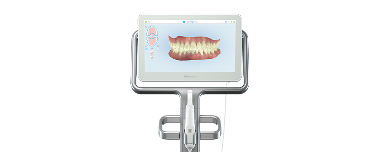口腔内スキャナー