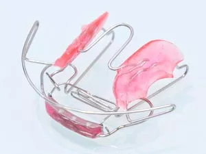 ビムラー矯正とは?